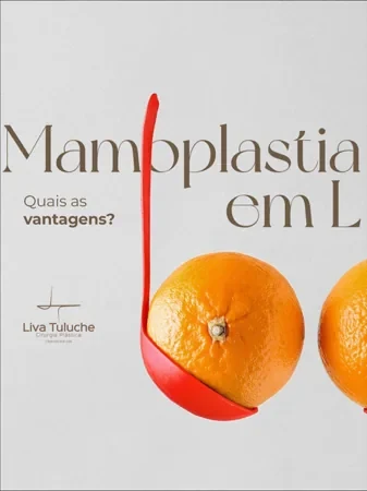 Mamoplastia em L: quais as vantagens?